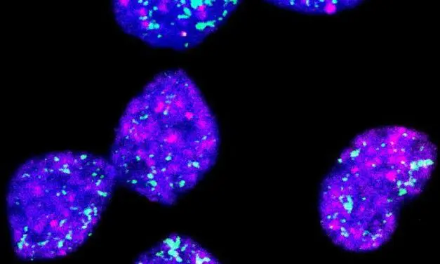 New therapeutic approach against aggressive neuroblastomas discovered