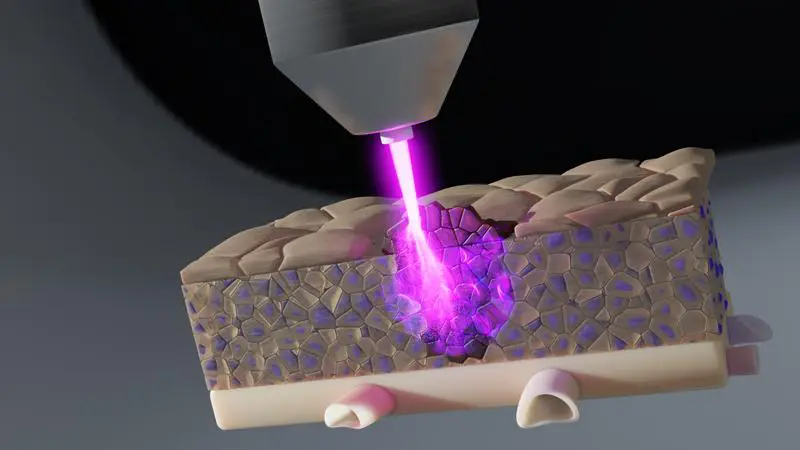 Cold plasma shows potential against cancer in deeper tissue layers