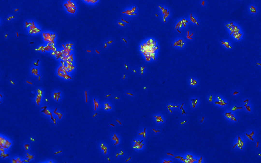 AI method DECIPHAER improves understanding of tuberculosis treatments