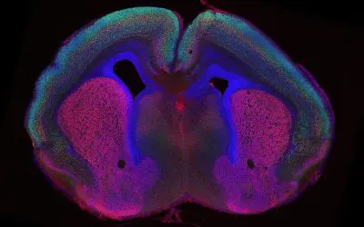 New study reveals mechanisms of brain fold formation
