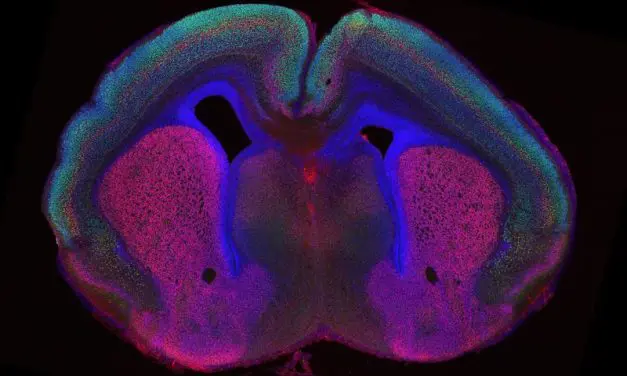 New study reveals mechanisms of brain fold formation