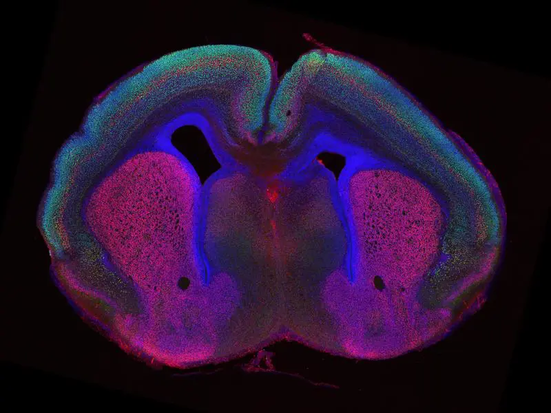 New study reveals mechanisms of brain fold formation