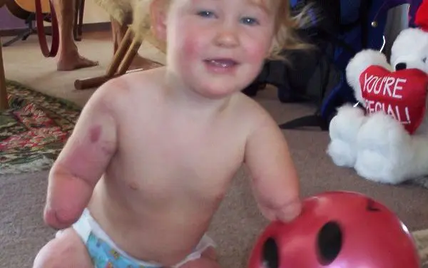 Meningitis: DGN urges meningococcal vaccination