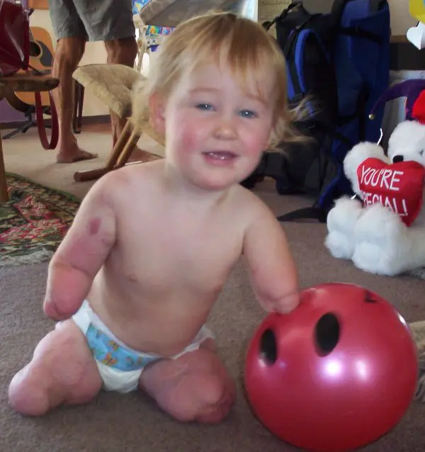 World Sepsis Day 2025: Prevention and protection against meningococcal disease