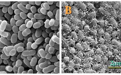 MedLab guide: How to protect your children from EHEC