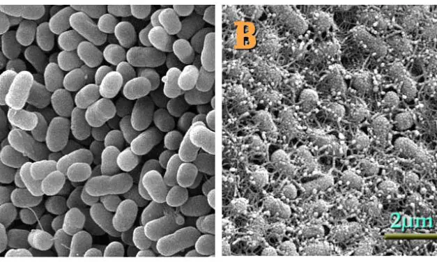 MedLab guide: How to protect your children from EHEC