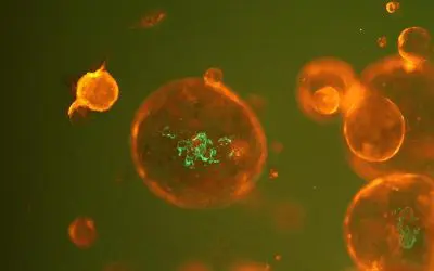 DFG funds research network on functional genomics and microbiomics in colorectal cancer