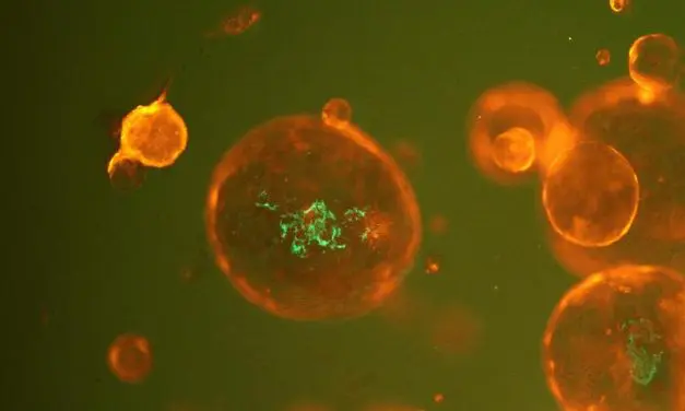 DFG funds research network on functional genomics and microbiomics in colorectal cancer