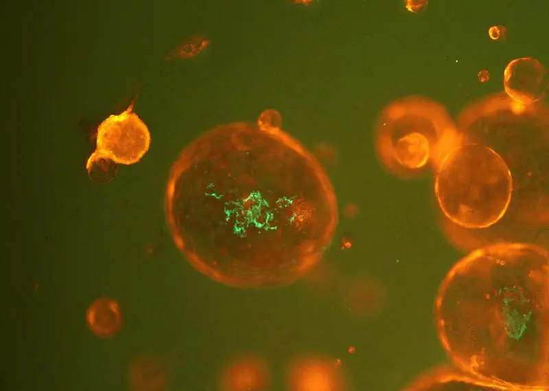 DFG funds research network on functional genomics and microbiomics in colorectal cancer