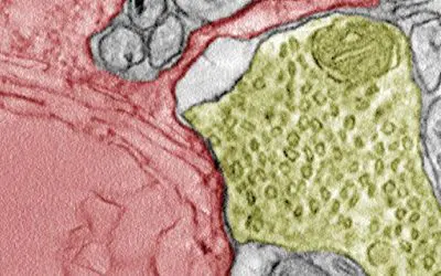 Cancer cells: Synapse formation with nerve cells promotes tumor growth