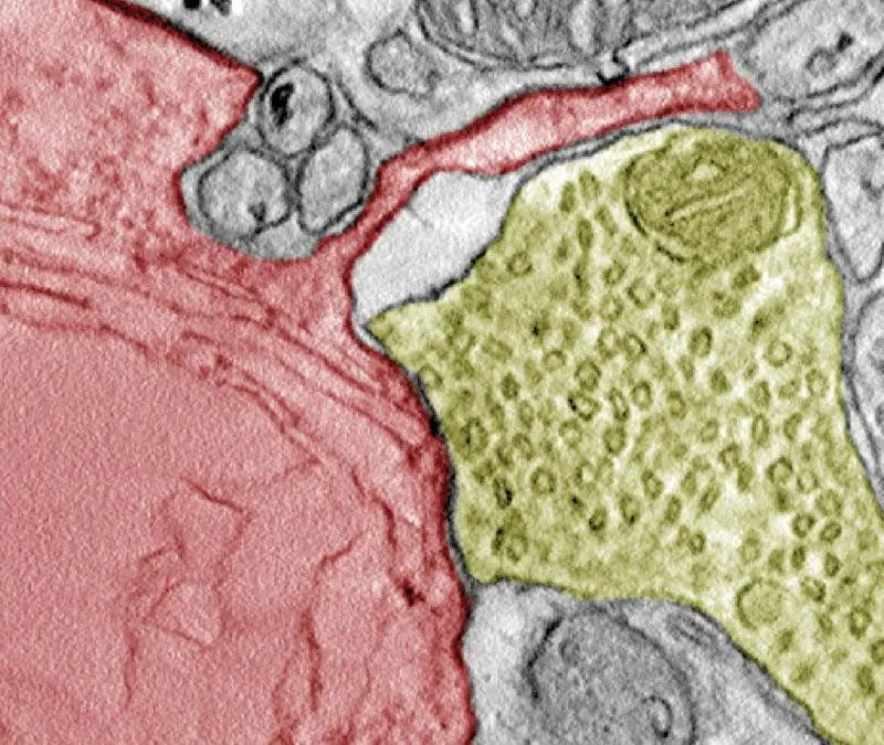 Cancer cells: Synapse formation with nerve cells promotes tumor growth