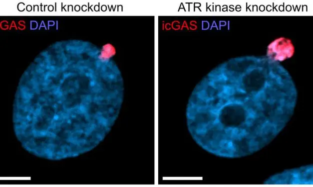 Protective mechanism enables cancer cells to survive under mechanical pressure