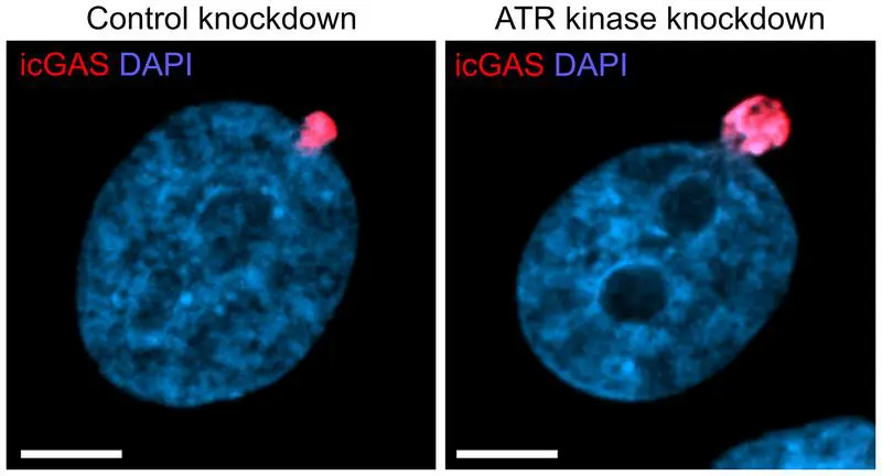 Protective mechanism enables cancer cells to survive under mechanical pressure