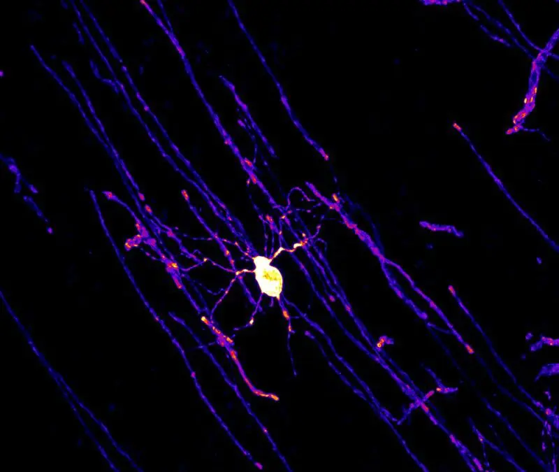 Erythropoietin: Growth factor promotes learning and thinking processes in the brain
