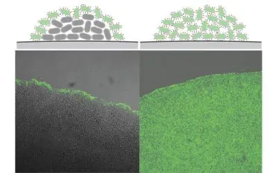 New insight into bacterial infections caused by Yersinia enterocolitica