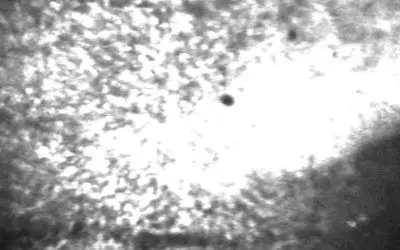 Bonn researchers discover mechanism for postictual wandering in epilepsy