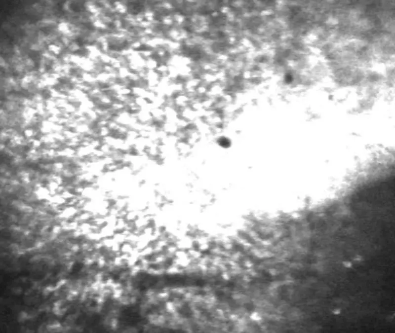 Bonn researchers discover mechanism for postictual wandering in epilepsy