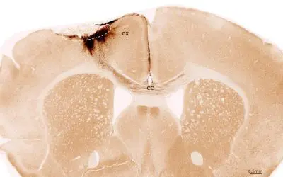 Stem cells repair stroke damage