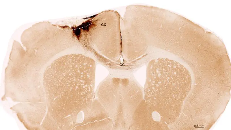 Stem cells repair stroke damage