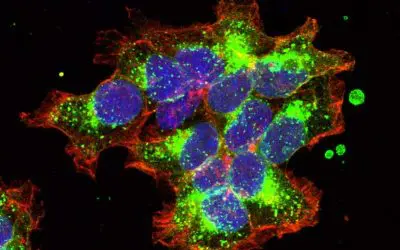 Patented process from Vienna opens up new avenues in breast cancer research