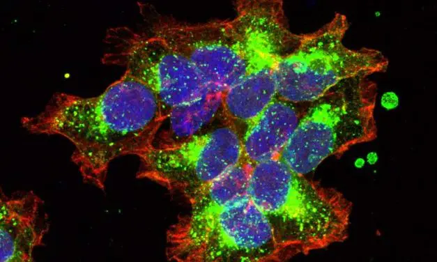 Patented process from Vienna opens up new avenues in breast cancer research