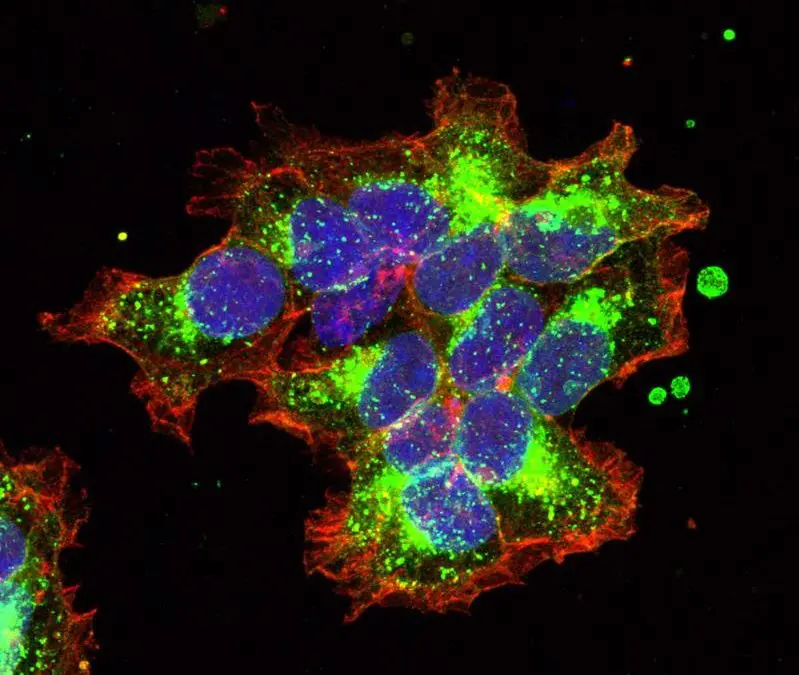 Patented process from Vienna opens up new avenues in breast cancer research