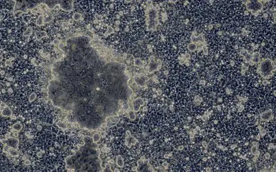 Progress in stem cell research: Better liver cells through genetic manipulation