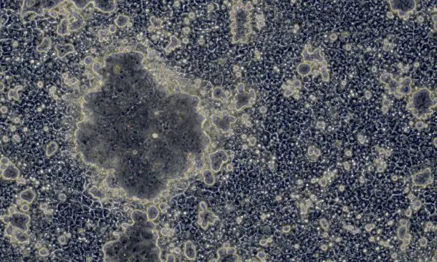 Progress in stem cell research: Better liver cells through genetic manipulation