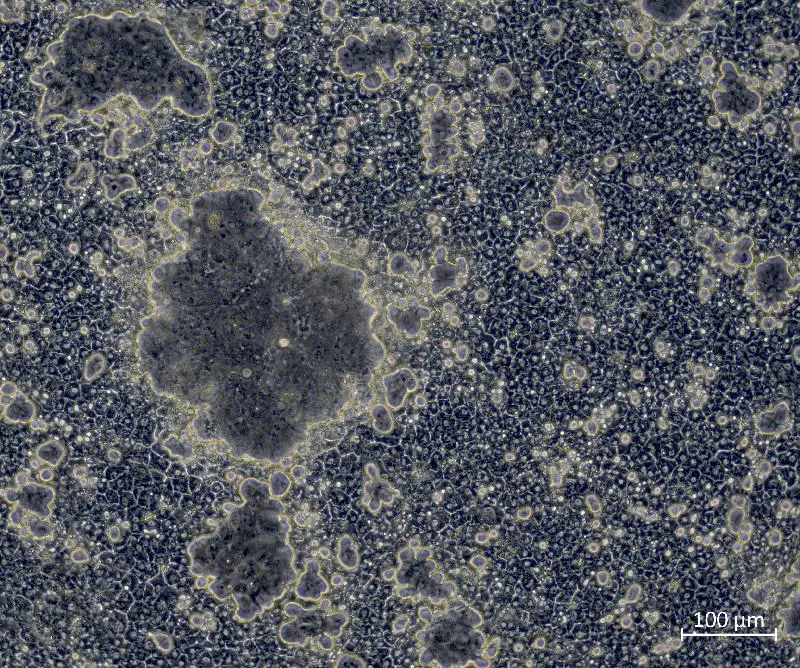 Progress in stem cell research: Better liver cells through genetic manipulation