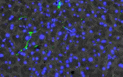 New insights into age-related pancreatic changes