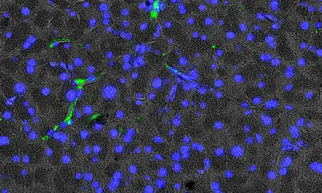 New insights into age-related pancreatic changes