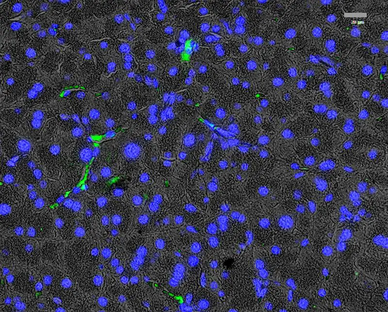 New insights into age-related pancreatic changes