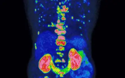 Award for groundbreaking method for the prognosis and treatment of prostate cancer