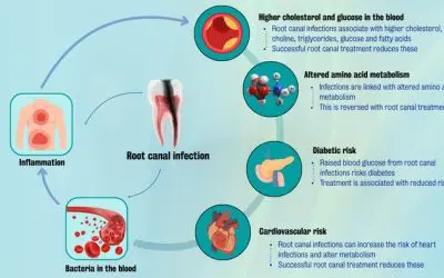 Root canal treatments reduce the risk of heart disease and diabetes