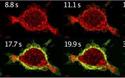 Calcium-sensitive switch increases the effectiveness of cancer drugs