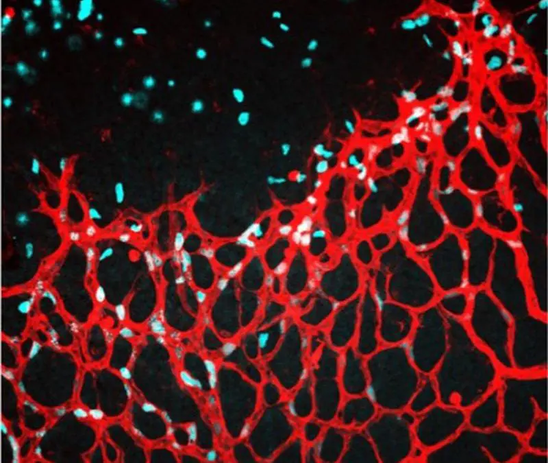 Heidelberg researchers reveal role of cystine in vascular growth