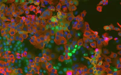 Bochum researchers discover cellular mechanism in coronaviruses