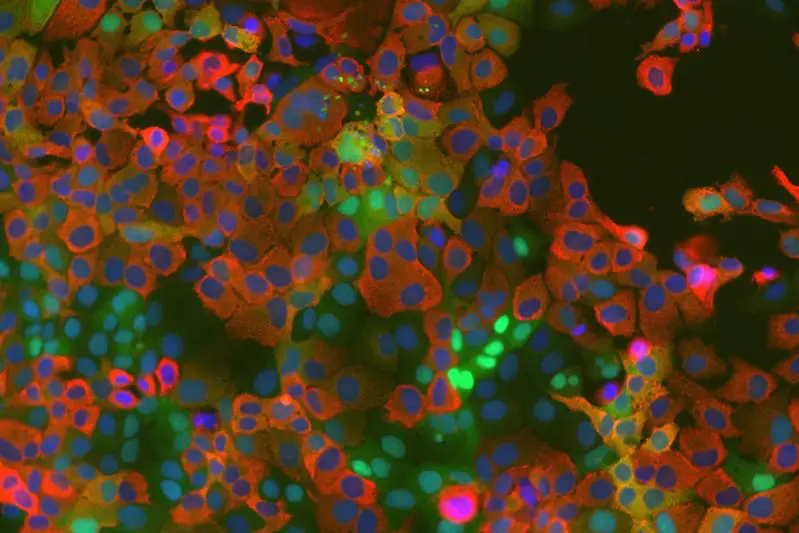 Bochum researchers discover cellular mechanism in coronaviruses