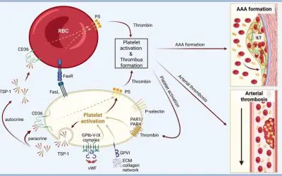 Düsseldorf team uncovers common cause of thrombosis and aneurysms