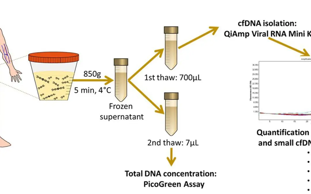 Groundbreaking urine test could revolutionize bladder cancer diagnosis