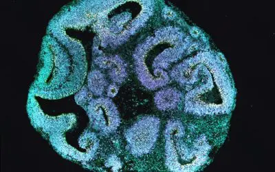 Brain organoids clarify the causes of rare developmental disorders