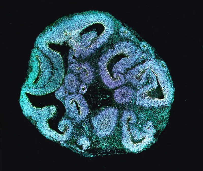 Brain organoids clarify the causes of rare developmental disorders