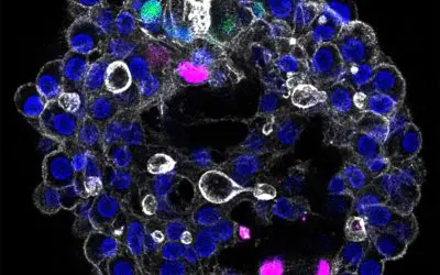 Groundbreaking: Dresden team develops modular 3D model of the human liver