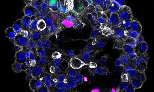 Groundbreaking: Dresden team develops modular 3D model of the human liver