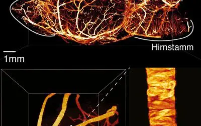 Research team optimizes light-sheet microscopy for precise 3D imaging