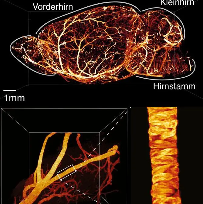 Research team optimizes light-sheet microscopy for precise 3D imaging