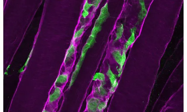 University of Basel discovers new approaches to severe muscle weakness