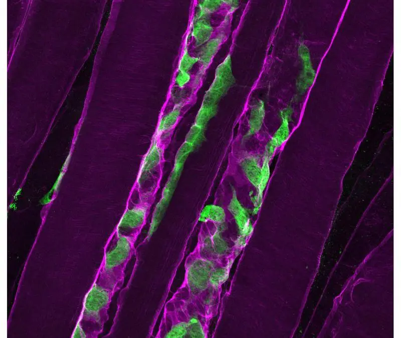 University of Basel discovers new approaches to severe muscle weakness