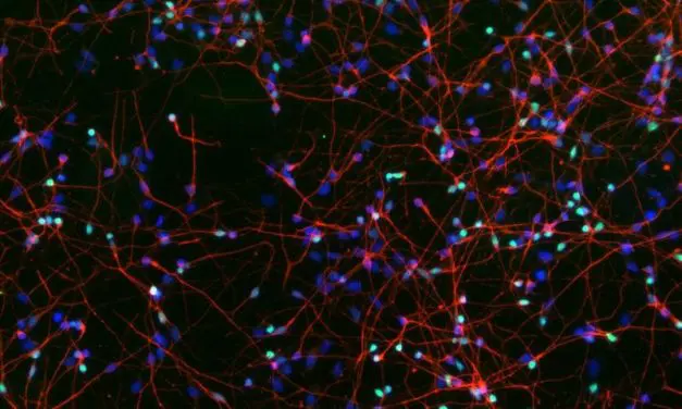 New protective mechanism against dementia discovered