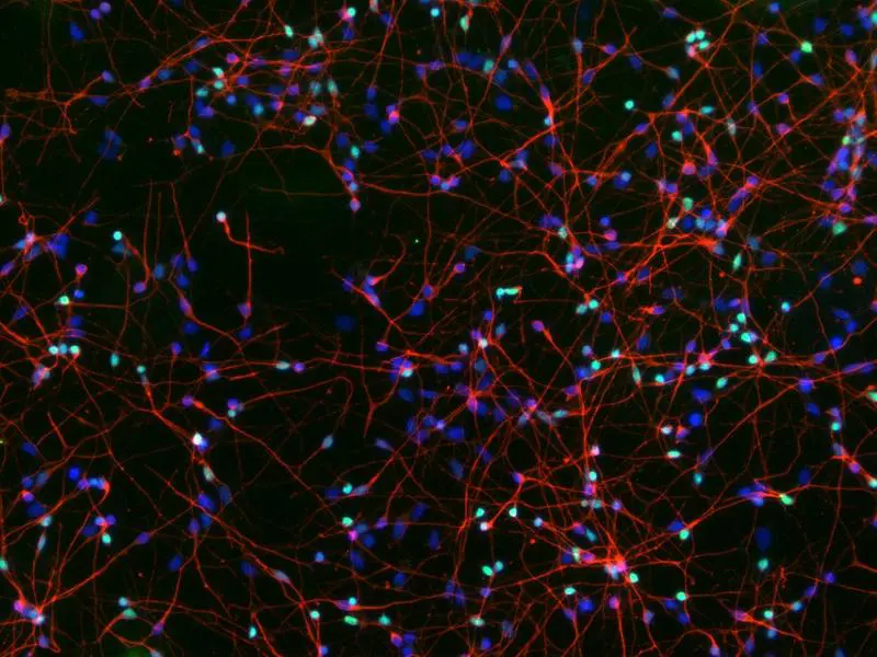 New protective mechanism against dementia discovered